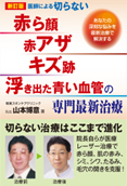 医師による切らない「赤ら顔・赤アザ・キズ跡・浮き出た青い血管」の専門最新治療